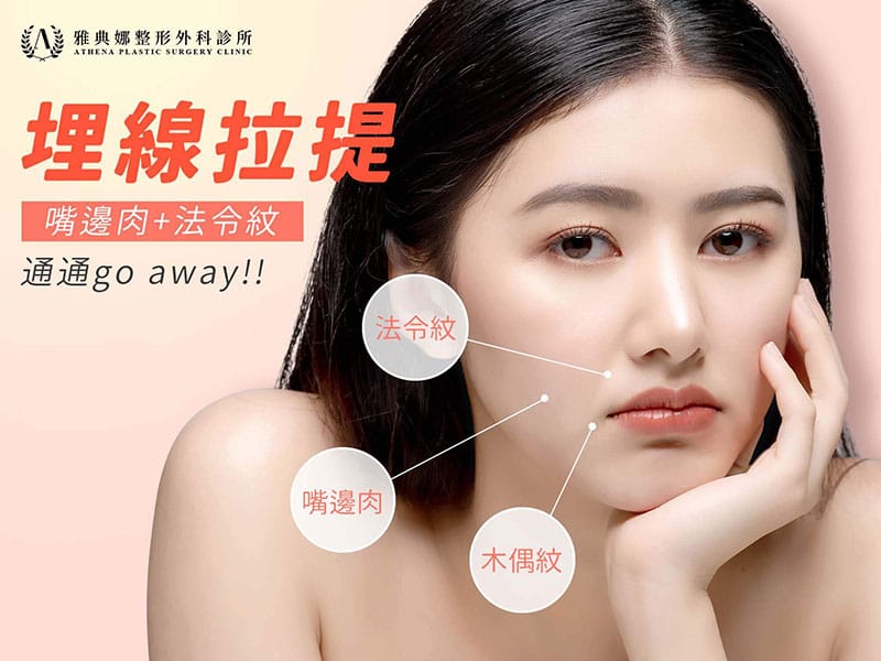 埋線拉提