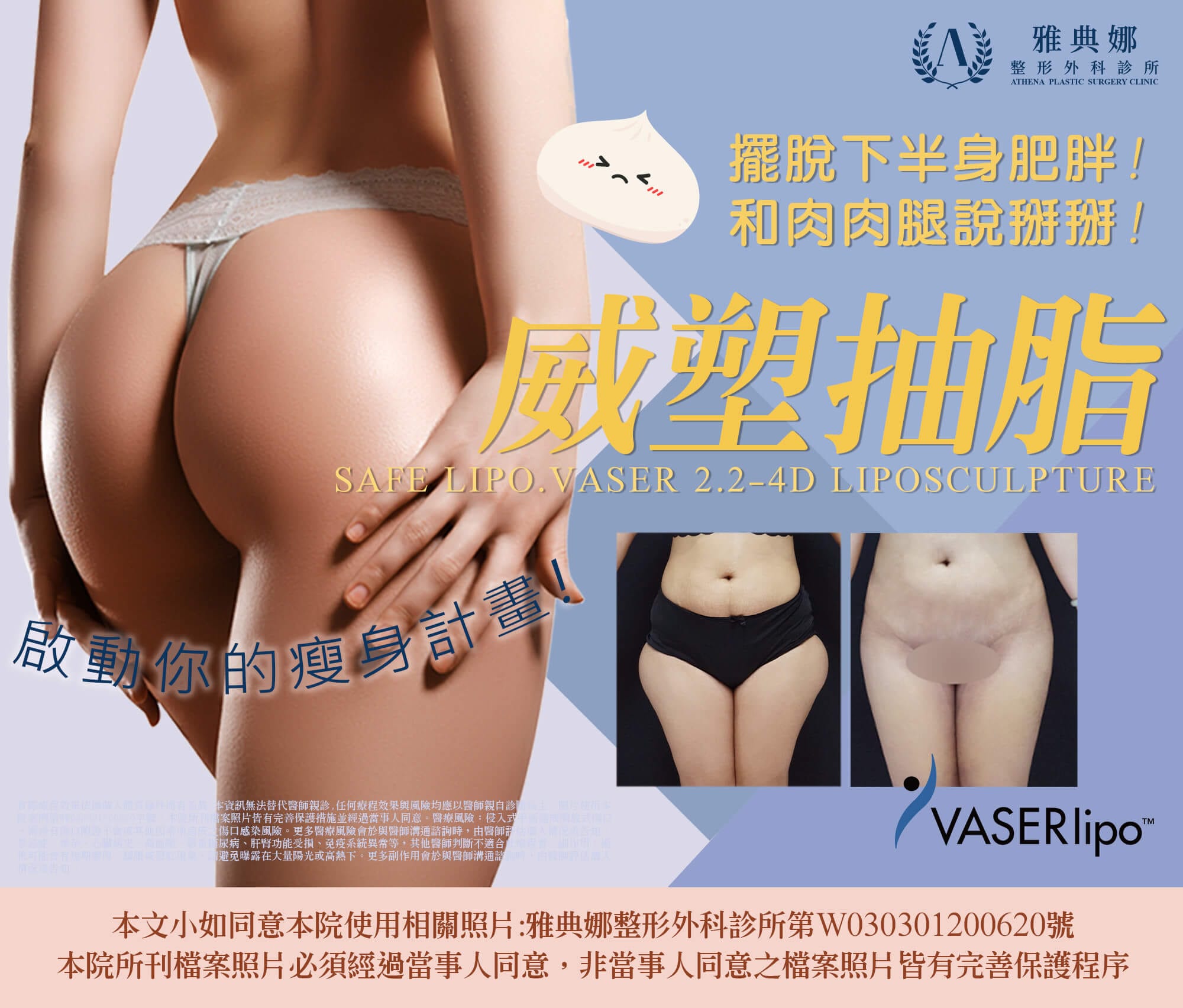 大腿抽脂,威塑抽脂